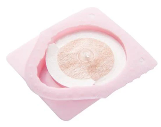 Seirin New Pyonex, 0.20 x 1.50 mm, pink