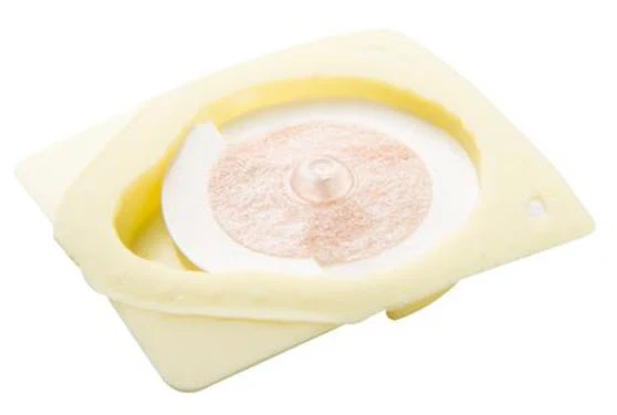 Seirin New Pyonex, 0.15 x 0.60 mm, gelb