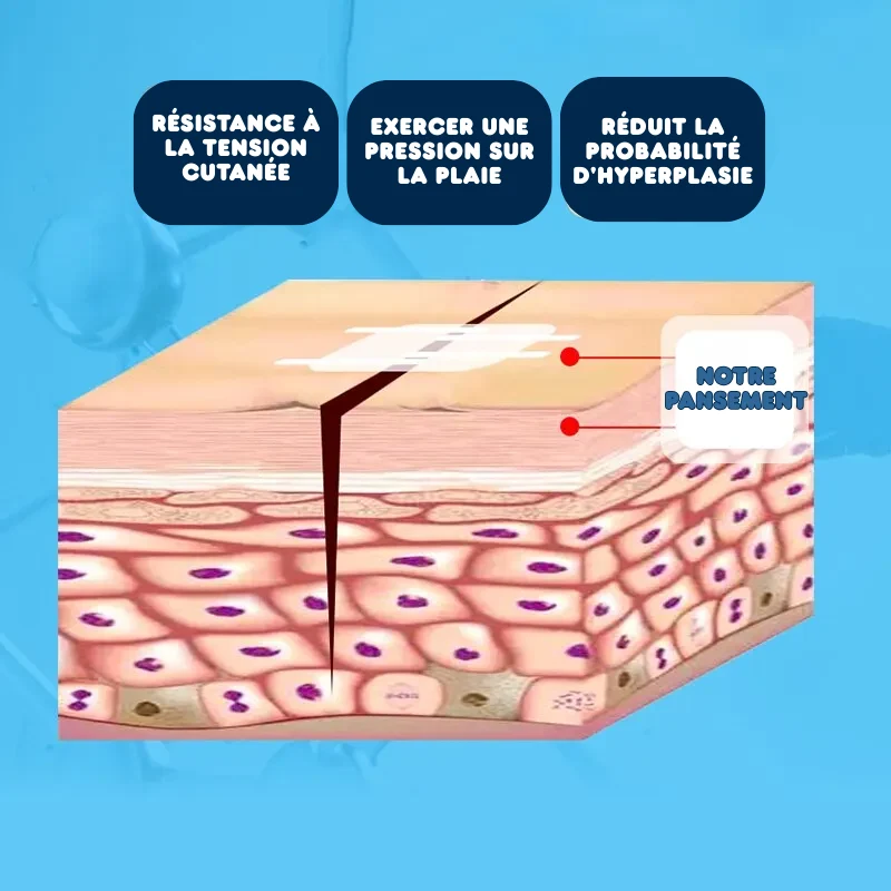 2x Pansements de Suture pour Plaie à Glissière