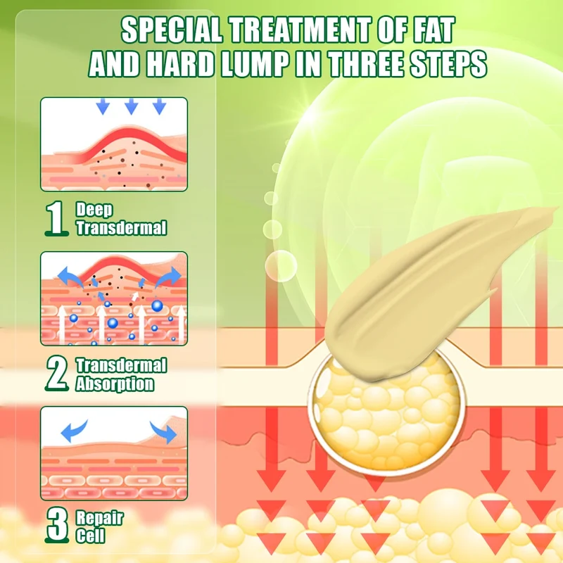 Crème Apaisante de Soin des Lipoemes et Nodosités