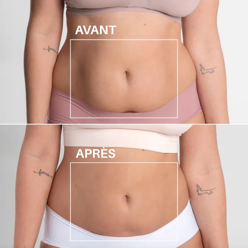 5x Patchs Magiques Ventre Plat à base de Plantes