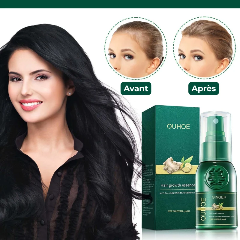 Sérum Capillaire au Gingembre Contre la Perte de Cheveux