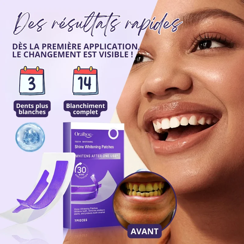14x Bandes de Blanchiment Dentaire au Gel Violet - EXPRESS' 30min