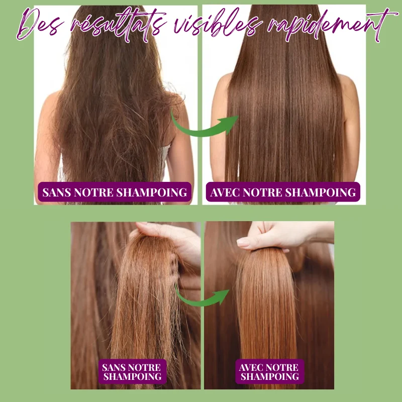 Duo Shampoing & Huile Pousse Accélérée et Anti-Chute - Brosse + Applicateur OFFERTS