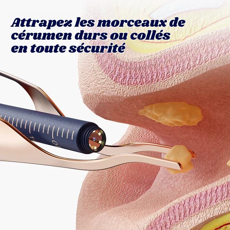 Nettoyeur 2 en 1 Oreilles & Nasal Connecté Intelligent