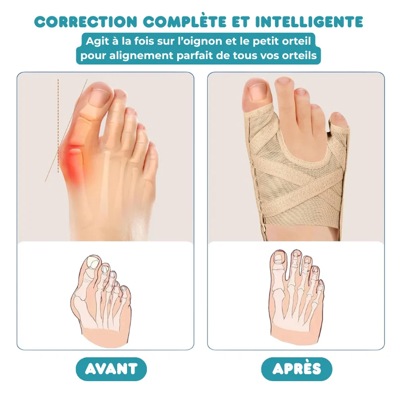 Correcteur d’Oignons Réglable en Tissu Respirant