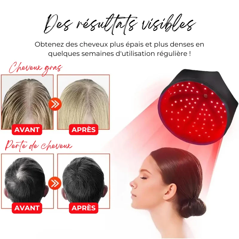 Bonnet de Photothérapie Infrarouge - Anti Perte de cheveux et Favorise la pousse