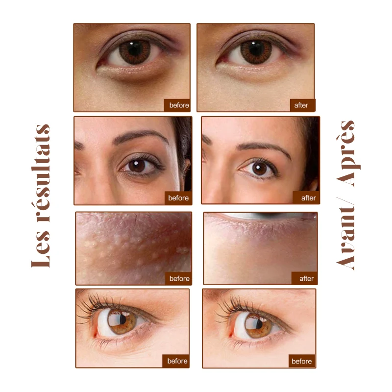 20x Patchs yeux anti-cernes Or Collagène & Acide Hyaluronique