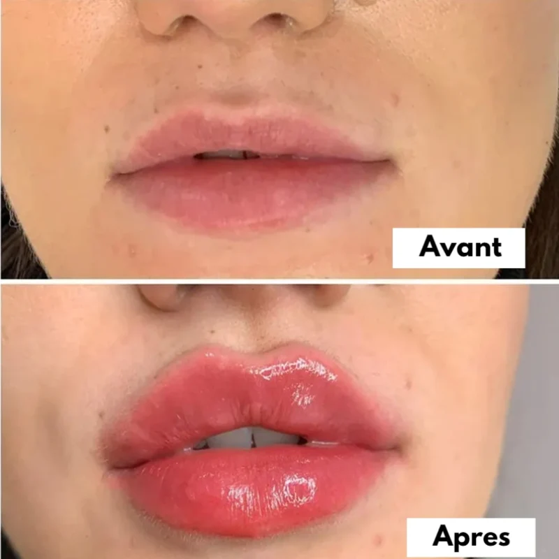 Sérum Magique pour des lèvres pulpeuses - Soins repulpant