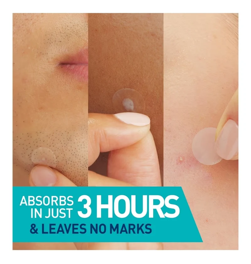 CeraVe Hydrocolloid Blemish Patches, Oil Absorbing Spot Control w/ Ceramides and Niacinamide - All Skin Tones (22ct)