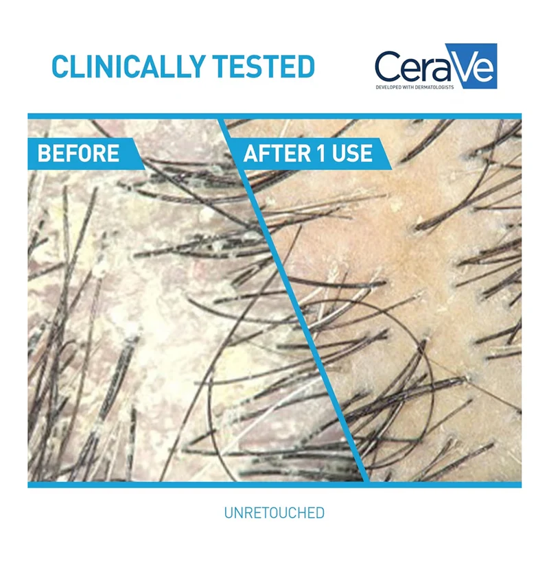CeraVe 2 In 1 Hydrating Anti Dandruff Shampoo And Conditioner, 1% Pyrithione Zinc Dandruff Treatment - Color Safe & Sulfate Free