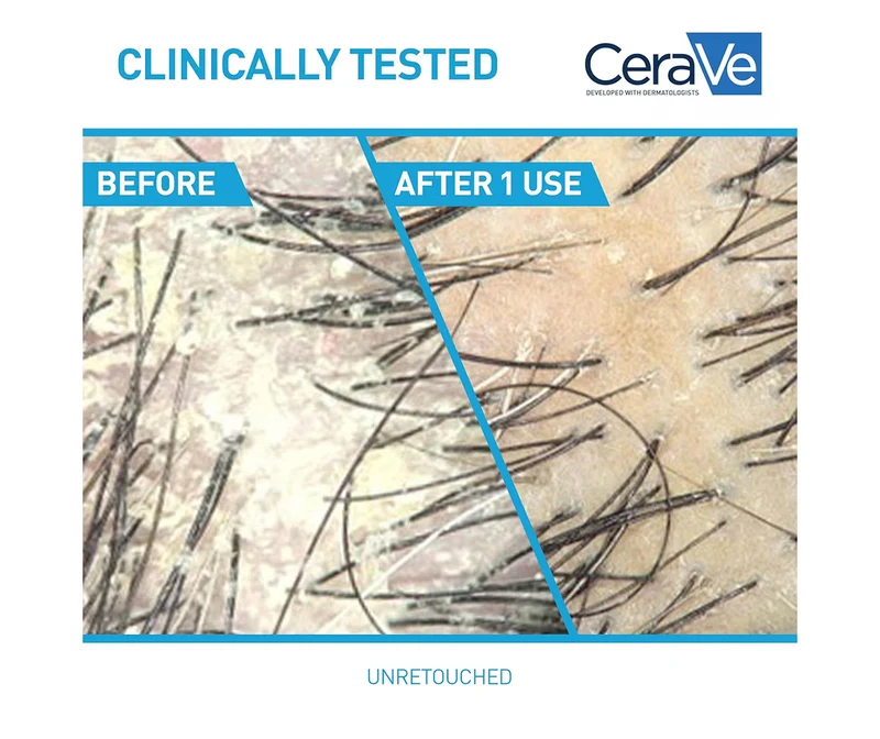 CeraVe Hydrating Anti Dandruff Shampoo, 1% Pyrithione Zinc Dandruff Treatment Eliminate Flakes & Itchy Scalp Relief, Sulfate Free (12 Oz)
