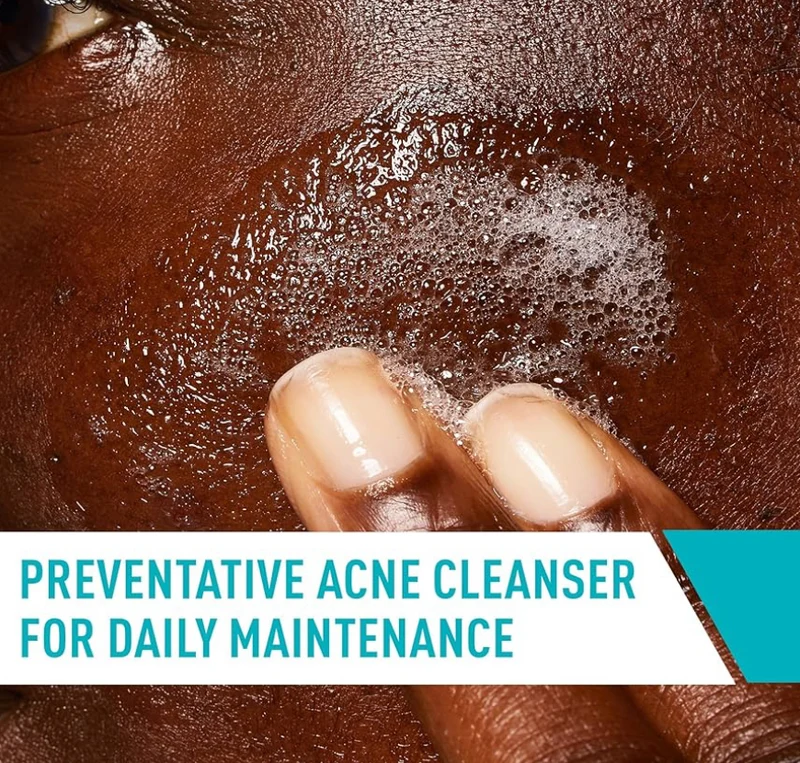CeraVe Acne Control Cleanser, 2% Salicylic Acid Treatment Formulated w/ Niacinamide + Ceramides + Oil Absorbing Clay Fragrance Free (16 Oz)