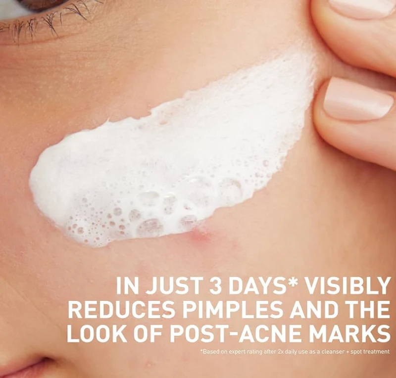 CeraVe Clay To Foam Acne Face Wash, Multi-Use Salicylic Acid & Kaolin Clay Acne Spot Treatment Fragrance-Free, Non-Comedogenic (4oz)