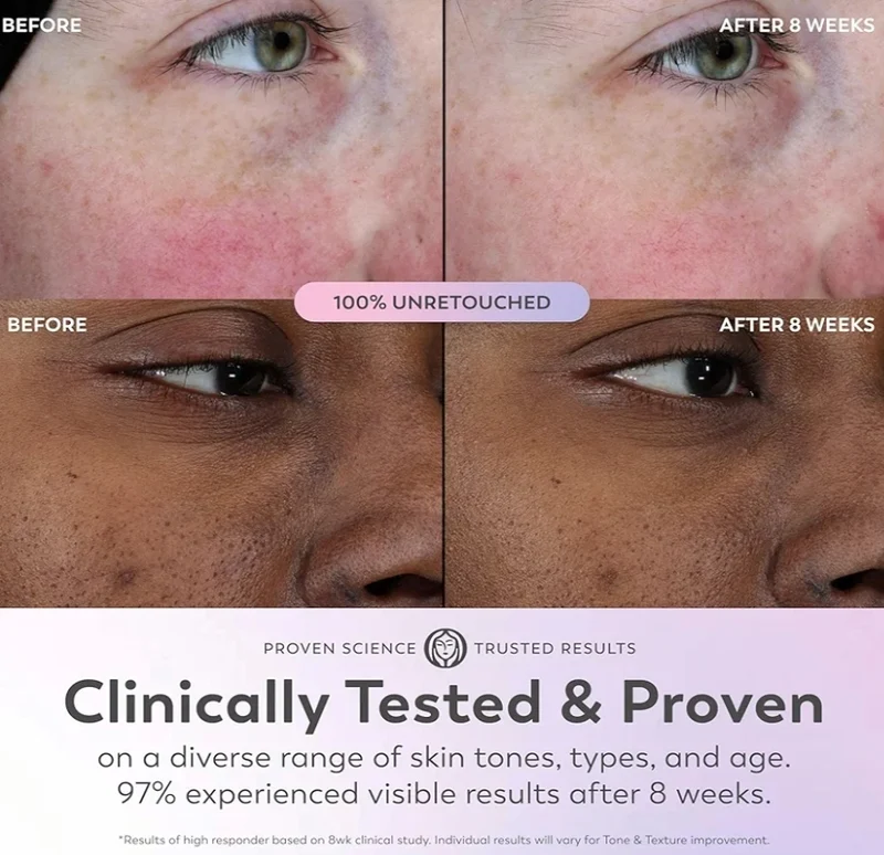 Olay Super Serum - Niacinamide, Vitamin C & E, Collagen Peptide, AHA - 5-in-1 Skin Care Brightening Anti-Aging (1.0 Oz)