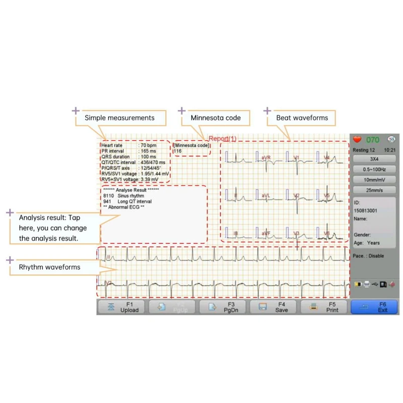 Checkme iE12A 12-Channel 12-Lead ECG Machine