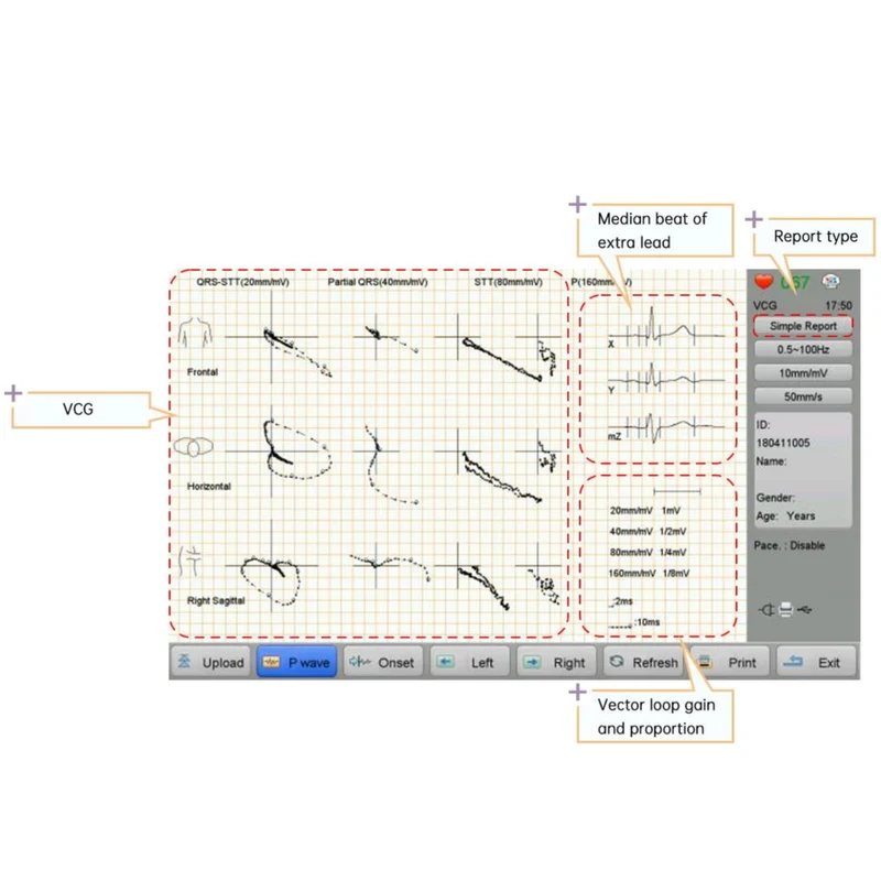 Checkme iE12A 12-Channel 12-Lead ECG Machine