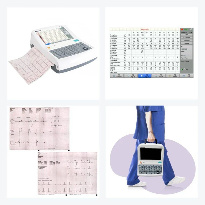 Checkme iE12A 12-Channel 12-Lead ECG Machine