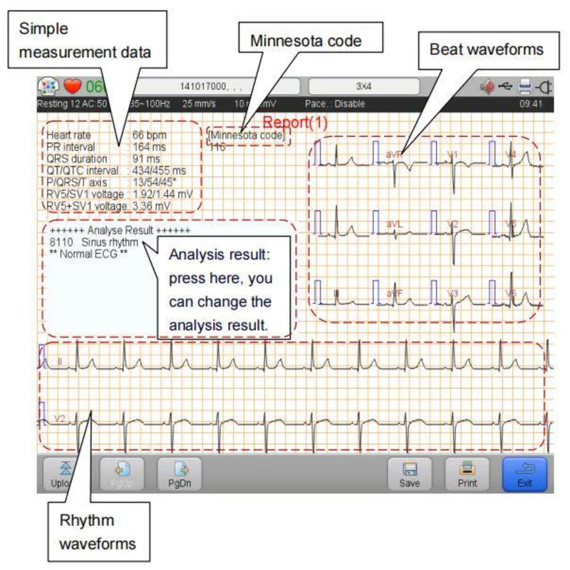 Checkme iE600 6-Channel 12-Lead ECG Machine