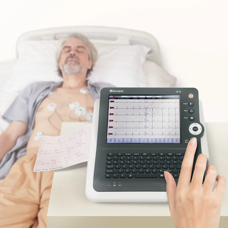 Checkme iE600 6-Channel 12-Lead ECG Machine