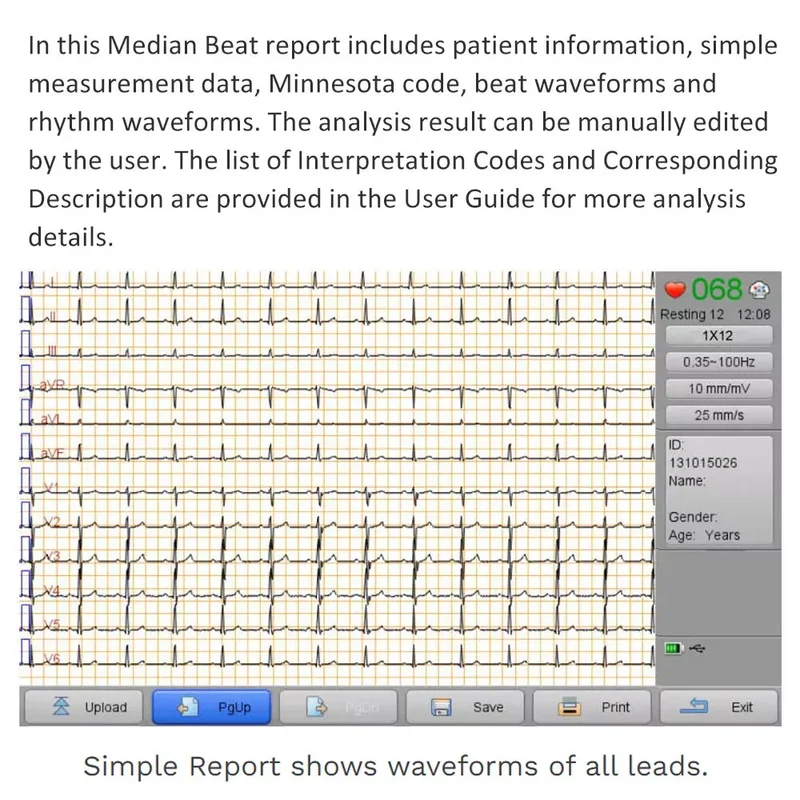 Checkme ECG Machine 3 Channel 12 Lead Portable Heart Diagnostic Auto Analysis EKG Printer, iE300