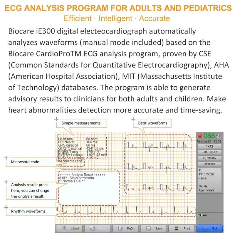 Checkme ECG Machine 3 Channel 12 Lead Portable Heart Diagnostic Auto Analysis EKG Printer, iE300