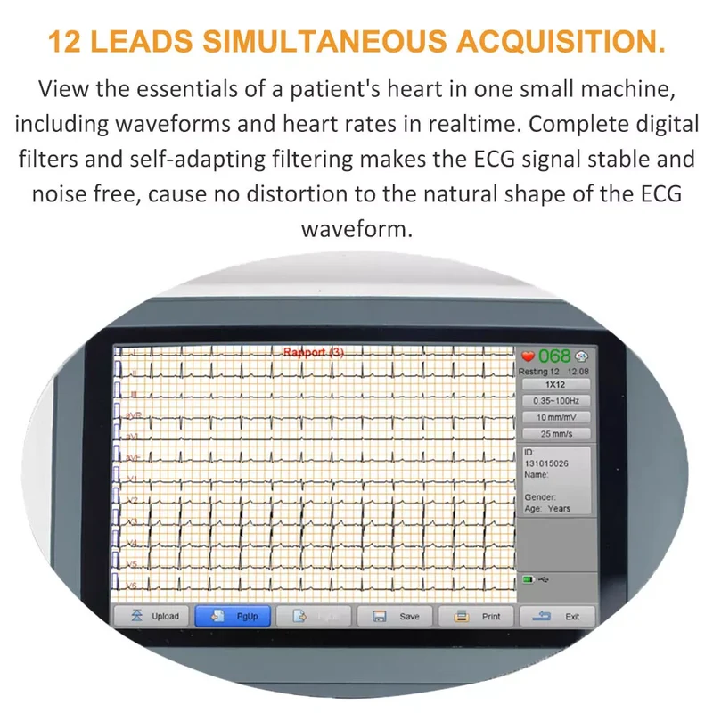 Checkme ECG Machine 3 Channel 12 Lead Portable Heart Diagnostic Auto Analysis EKG Printer, iE300