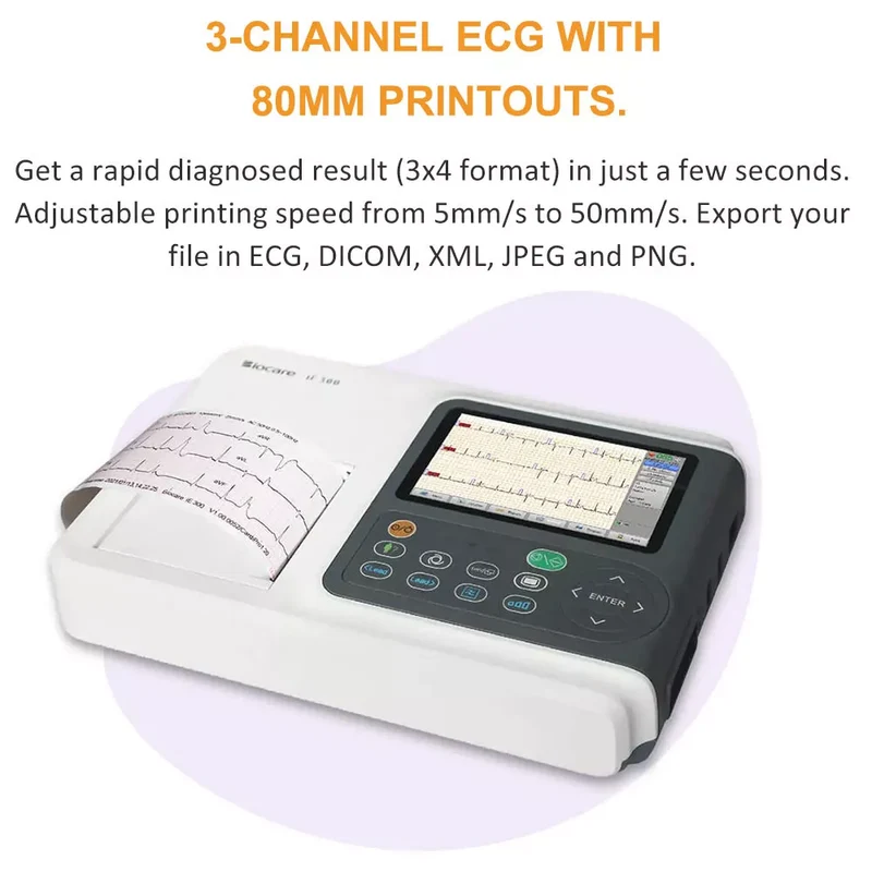 Checkme ECG Machine 3 Channel 12 Lead Portable Heart Diagnostic Auto Analysis EKG Printer, iE300