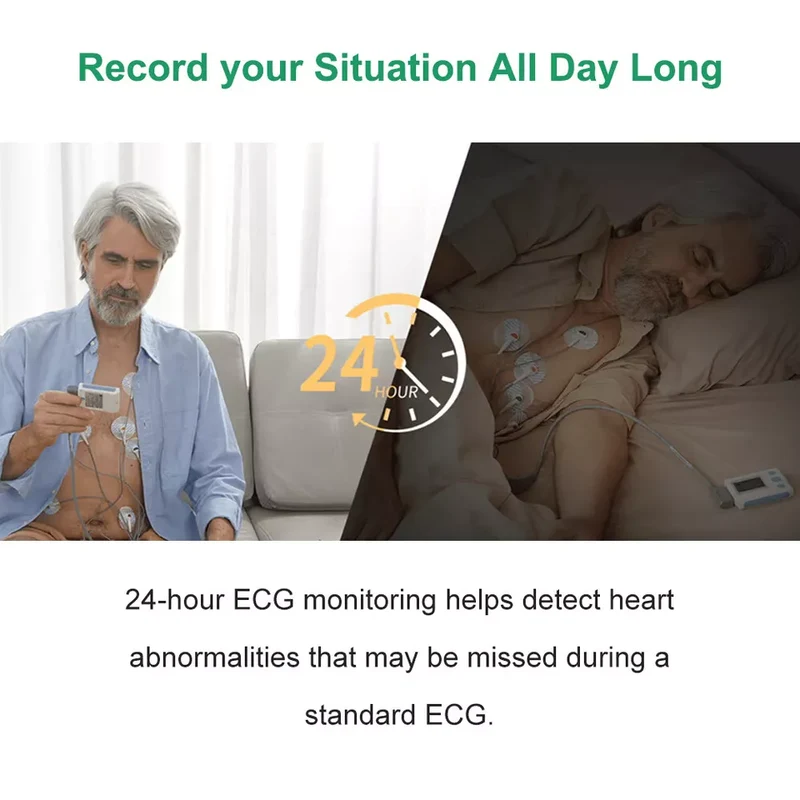 Wellue 12-Lead ECG Holter Monitor