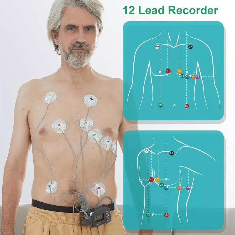 Wellue 12-Lead ECG Holter Monitor