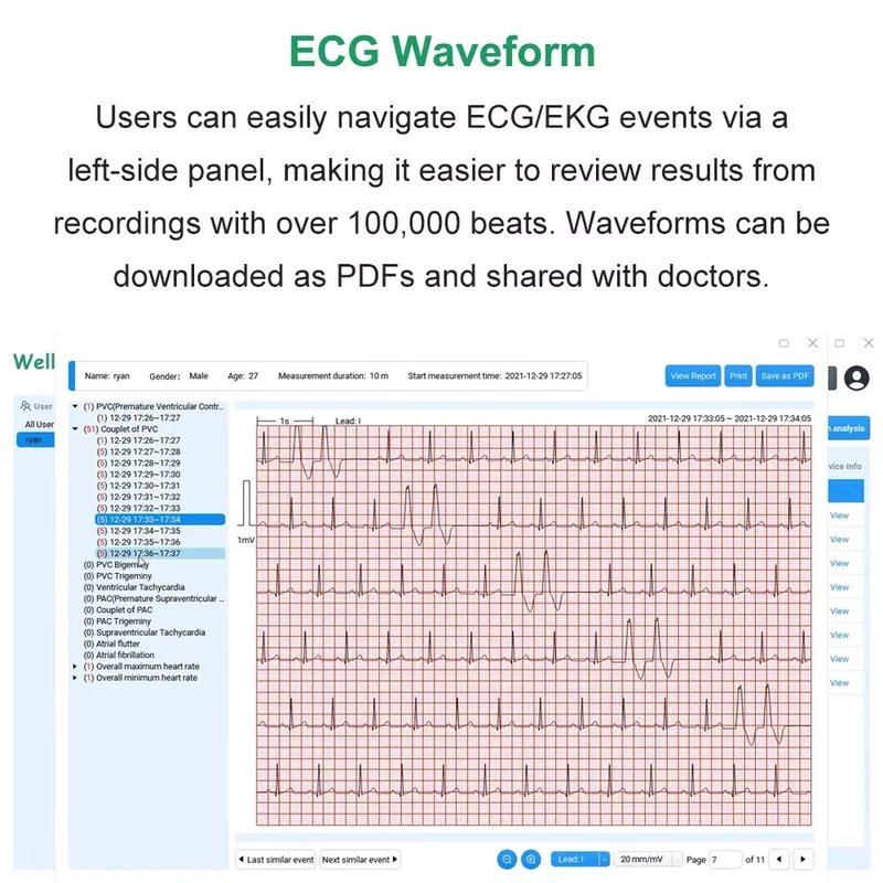 Wellue 12-Lead ECG Holter Monitor