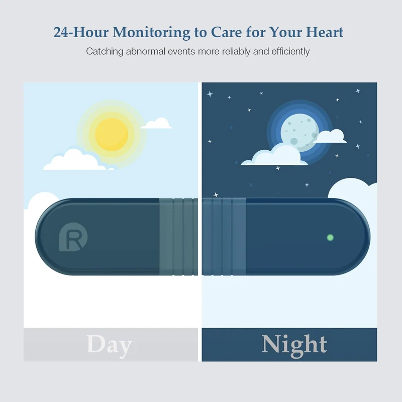Checkme ER1 24 Hours AI ECG Holter (EU)