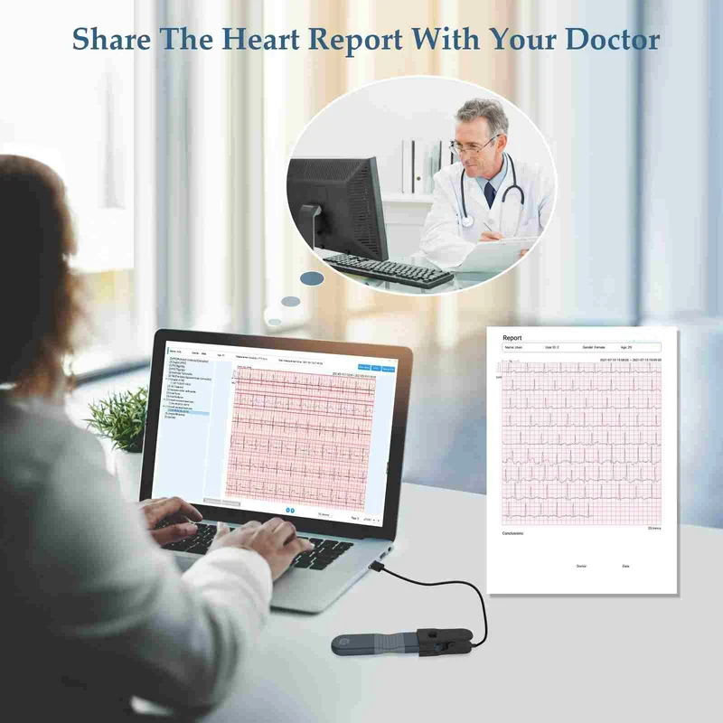 Checkme ER1 24 Hours AI ECG Holter (EU)