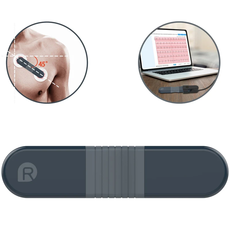 Checkme ER1 24 Hours AI ECG Holter (EU)