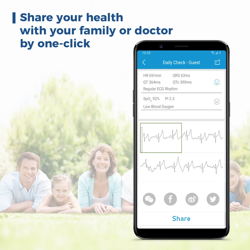 Checkme Lite SpO2 & ECG Monitor